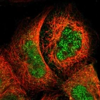 Immunofluorescent staining of human cell line A-431 shows localization to nucleoplasm & cytosol.