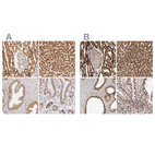 Anti-ATP5B Antibody