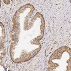 Immunohistochemical staining of human prostate shows moderate granular cytoplasmic positivity in glandular cells.