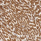 Immunohistochemical staining of human liver shows strong granular cytoplasmic positivity in hepatocytes.