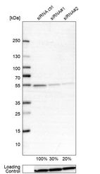 Western blot analysis in A-549 cells transfected with control siRNA, target specific siRNA probe #1 and #2, using Anti-ATP5B antibody. Remaining relative intensity is presented. Loading control: Anti-GAPDH.