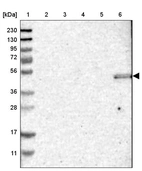 Lane 1: Marker [kDa] 230, 130, 95, 72, 56, 36, 28, 17, 11_br/_Lane 2: Human cell line RT-4_br/_Lane 3: Human cell line U-251 MG_br/_Lane 4: Human plasma_br/_Lane 5: Human Liver tissue_br/_Lane 6: Human Tonsil tissue