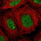 Immunofluorescent staining of human cell line A-431 shows localization to nucleoplasm & nuclear bodies.