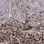 Immunohistochemical staining of human skin shows moderate to strong cytoplasmic positivity in dermal cells.