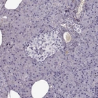 Immunohistochemical staining of human pancreas shows no positivity in exocrine glandular cells as expected.
