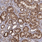 Anti-HSPD1 Antibody