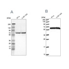 Anti-HSPD1 Antibody