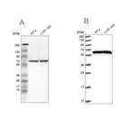 Western blot analysis using Anti-HSPD1 antibody HPA001523 (A) shows similar pattern to independent antibody HPA050025 (B).