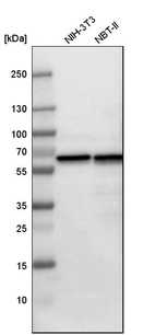 Anti-HSPD1 Antibody