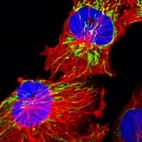 Immunofluorescent staining of human cell line U-251 MG shows localization to mitochondria.