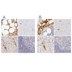 Anti-AHSG Antibody