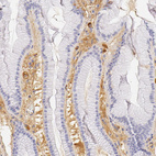 Immunohistochemical staining of human stomach shows moderate positivity in extracellular matrix.