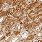 Anti-AHSG Antibody