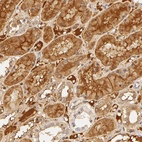 Immunohistochemical staining of human kidney shows moderate extra-cellular positivity and moderate cytoplasmic positivity in cells in tubules.