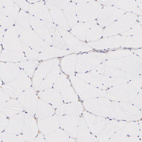 Immunohistochemical staining of human skeletal muscle shows no positivity in myocytes as expected.