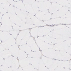 Immunohistochemical staining of human skeletal muscle shows no positivity in myocytes as expected.