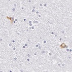 Anti-AHSG Antibody