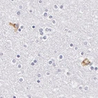 Immunohistochemical staining of human cerebral cortex using Anti-AHSG antibody HPA001524.