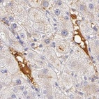 Anti-AHSG Antibody