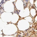 Immunohistochemical staining of human bone marrow using Anti-AHSG antibody HPA001524.