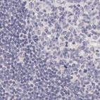 Anti-AHSG Antibody