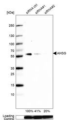 Western blot analysis in Caco-2 cells transfected with control siRNA, target specific siRNA probe #1 and #2, using Anti-AHSG antibody. Remaining relative intensity is presented. Loading control: Anti-GAPDH.