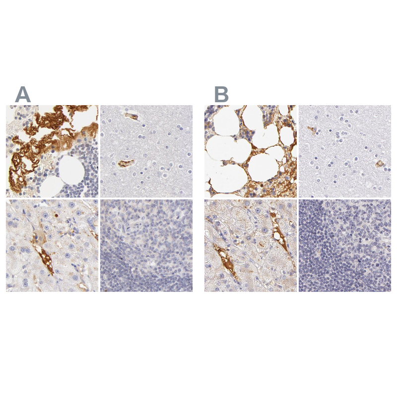 Anti-AHSG Antibody