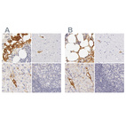 Anti-AHSG Antibody