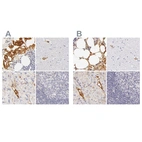 Anti-AHSG Antibody