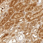 Immunohistochemical staining of human kidney shows moderate extra-cellular positivity and moderate cytoplasmic positivity in cells in tubules.