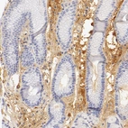 Immunohistochemical staining of human stomach shows moderate positivity in extracellular matrix.