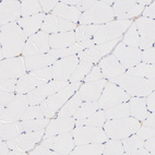 Immunohistochemical staining of human skeletal muscle shows no cytoplasmic positivity in myocytes as expected.