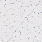 Immunohistochemical staining of human skeletal muscle shows no cytoplasmic positivity in myocytes as expected.