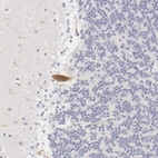 Immunohistochemical staining of human cerebellum shows moderate cytoplasmic positivity in a subset of Purkinje cells.