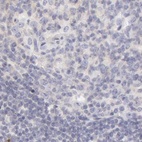 Anti-AHSG Antibody