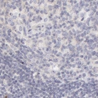 Immunohistochemical staining of human lymph node using Anti-AHSG antibody HPA001525.