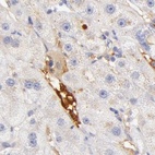 Anti-AHSG Antibody