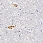 Anti-AHSG Antibody