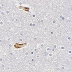 Immunohistochemical staining of human cerebral cortex using Anti-AHSG antibody HPA001525.