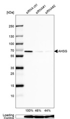 Anti-AHSG Antibody