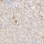 Anti-GC Antibody