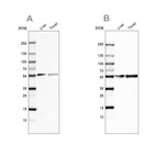 Western blot analysis using Anti-GC antibody HPA001526 (A) shows similar pattern to independent antibody HPA019855 (B).