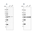 Anti-GC Antibody