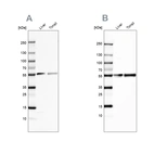 Western blot analysis using Anti-GC antibody HPA001526 (A) shows similar pattern to independent antibody HPA019855 (B).