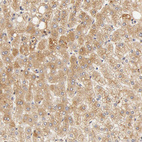 Immunohistochemical staining of human liver shows moderate cytoplasmic positivity in hepatocytes.