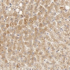 Immunohistochemical staining of human liver shows moderate cytoplasmic positivity in hepatocytes.