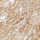 Immunohistochemical staining of human kidney shows strong positivity in plasma in cells in tubules.