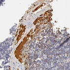 Immunohistochemical staining of human lymph node shows strong positivity in plasma in non-germinal center cells.