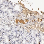 Immunohistochemical staining of human duodenum shows moderate to strong positivity in plasma in glandular cells.