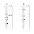 Anti-TF Antibody